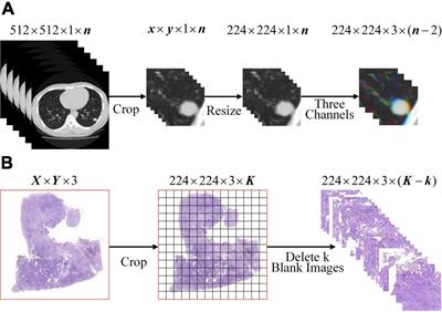 A brain-like classification method for computed tomography images based on adaptive feature matching dual-source domain heterogeneous transfer learning